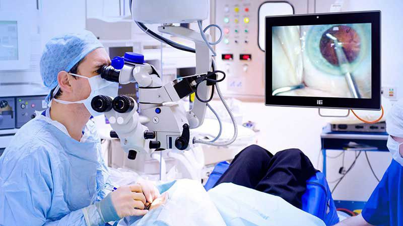 انواع عمل جراحی چشم