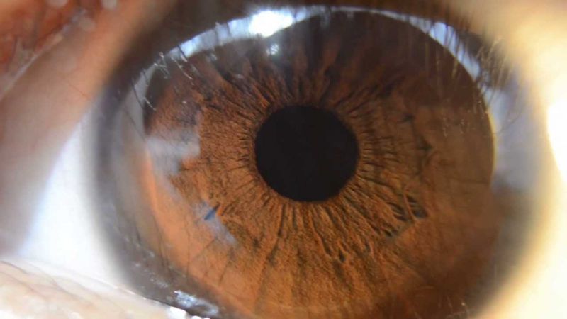 عوامل تعیین کننده رنگ چشم چیست؟